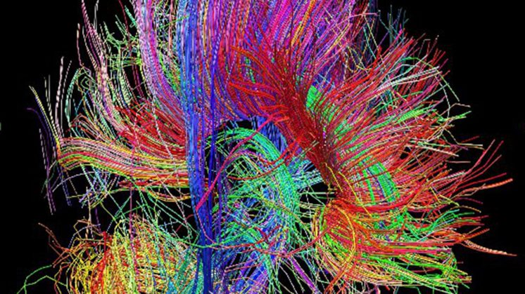 . Arquitectura de las fibras de materia blanca, que informa acerca de la relación entre regiones cerebrales, cortesía del proyecto Human Connectome.