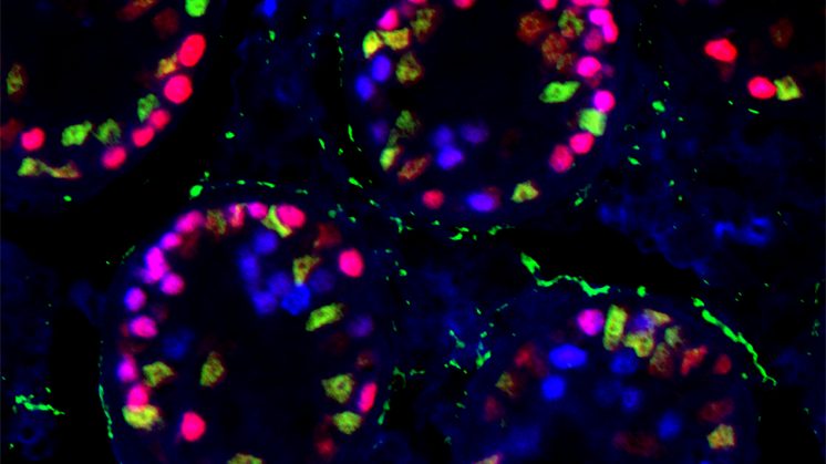 Imagen en la que aparecen túbulos seminíferos de un testículo mutante. Foto: UGR / aG 