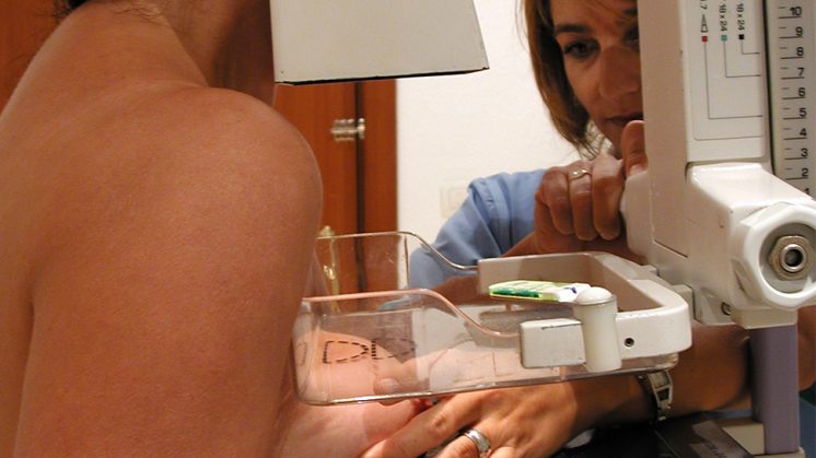 La detección temprana a través de la realización de mamografías permite mejorar el pronóstico de la enfermedad. Foto: aG